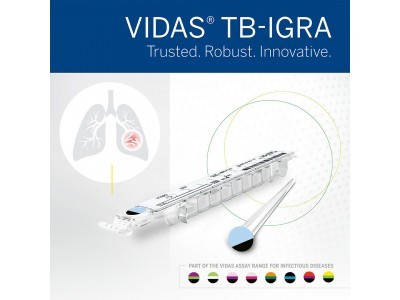 Новият тест VIDAS TB-IGRA